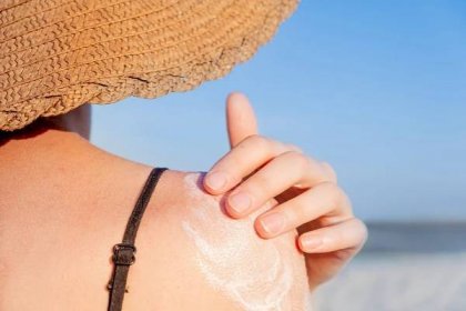 Co dělat při alergii na slunce? Chránit pokožku a nezapomenout na hydrataci!