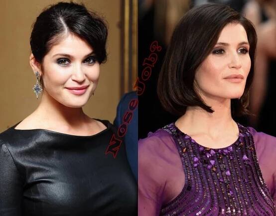 Did Gemma Arterton Had Nose Job Plastic Surgery Or Not