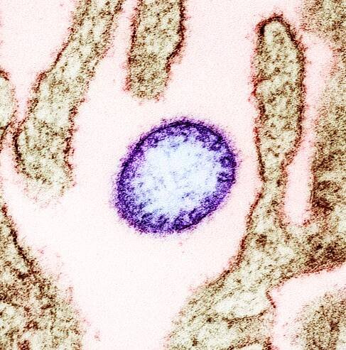 Nipah virus outbreaks in Kerala