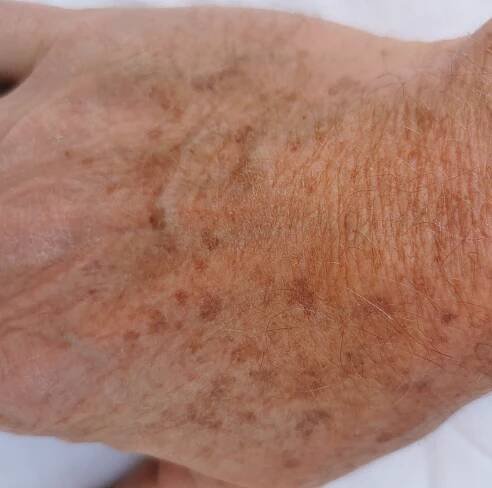 hand pigment 2