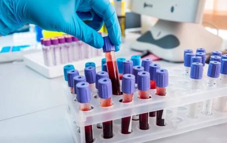Demystifying Blood Chemistry: An Introductory Guide