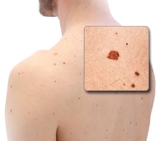 Digitální dermatoskop FotoFinder ATBM MASTER 4. generace - MEDICALTECH s.r.o.