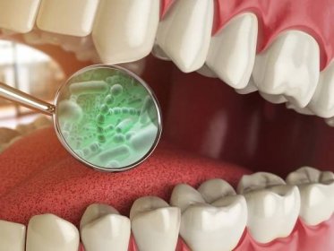 Infections of dental implants: symptoms? Do antibiotics work?
