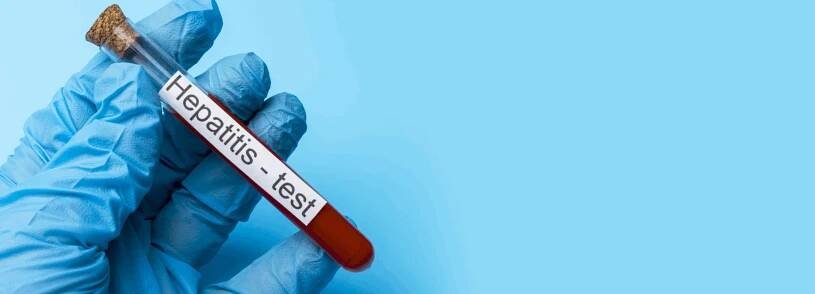 Virová hepatitida A – aktuální informace a prevence - Krajská hygienická stanice Ústeckého kraje se sídlem v Ústí nad labem