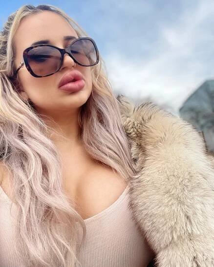 Živoucí Barbie Jessy Bunny: 700 tisíc za gigantická prsa a kačeří pysky! A tím nekončí