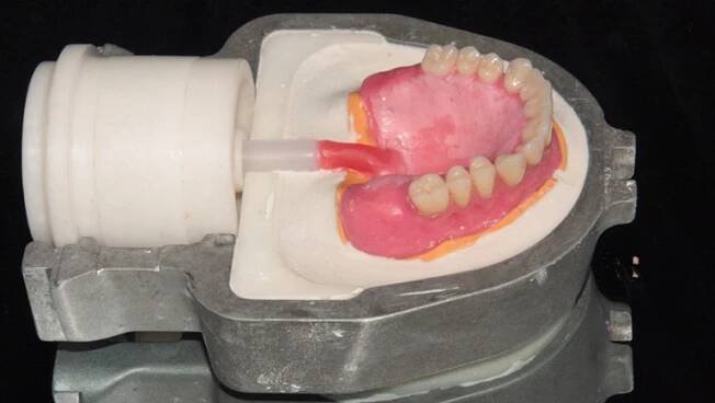 Nylonové protézy: Posouzení, cena, druhy | City Dental