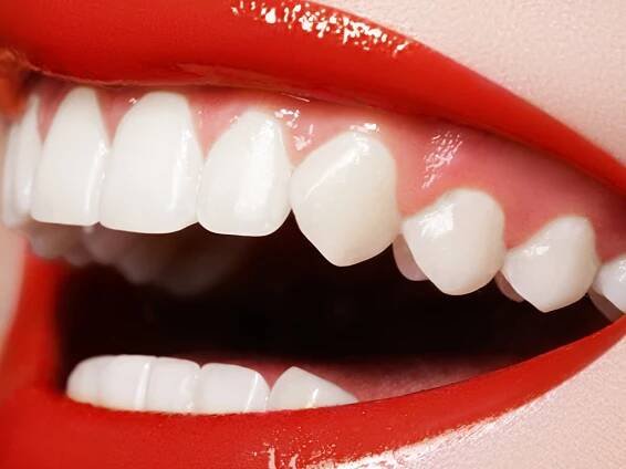 Ideas on the health advantages of Teeth Bleaching