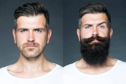 beard-growth