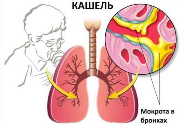 Jak se zbavit léků proti kašli / Články | Užitečné informace a tipy na péči o sebe. Zdraví, výživa a další.