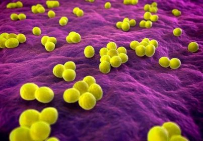 V léčbě stafylokokových infekcí se uplatňují různé druhy antibiotik