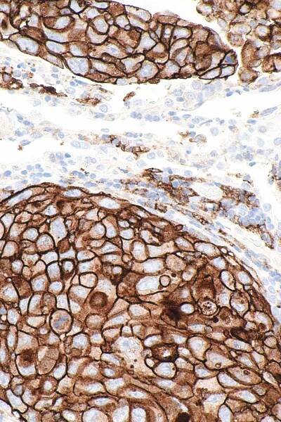 PD-1 and PD-L1 inhibitors