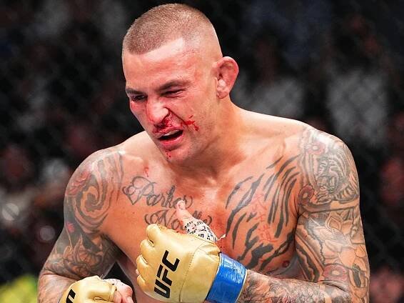Dustin Poirier Says He Suffered Broken Nose, Rib During UFC 302 Fight