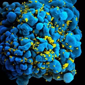 New Class of Proteins Inhibit HIV Infection in Cell Cultures