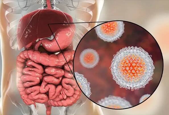 Hepatitis Immunizations: Vaccine Schedule for Adults, Newborn