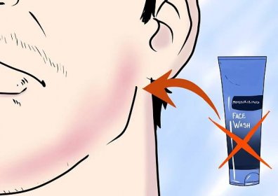 Jak se zbavit podráždění kůže po holení: 14 Kroků (s obrázky)