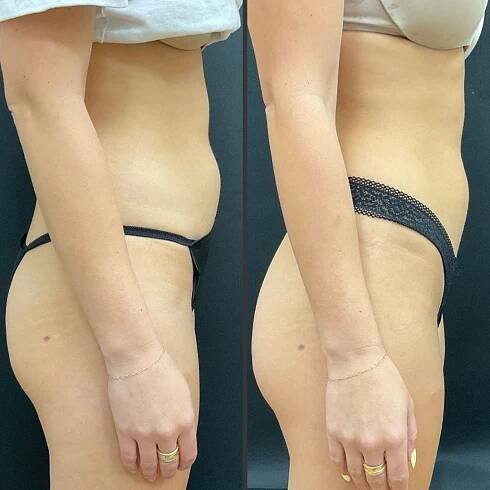 Non-Surgical Procedures Archives - My Plastic Surgery Group