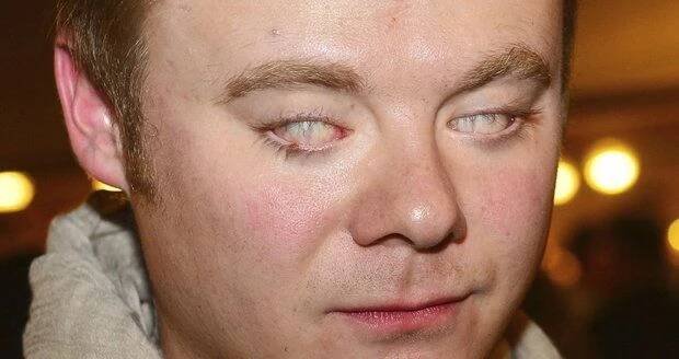 "Když jsem byl malý, tak jsem podstoupil operaci očí," říká Filip Kaňkovský.