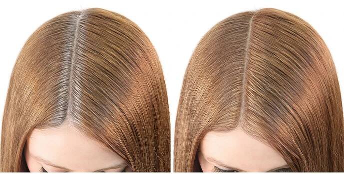 Root Cover Up