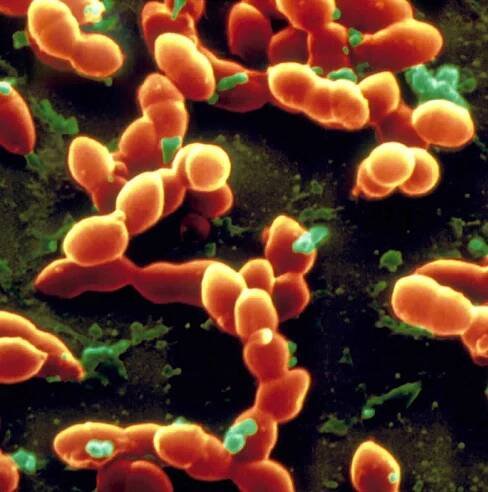 A close up of a bunch of orange bacteria on a black background