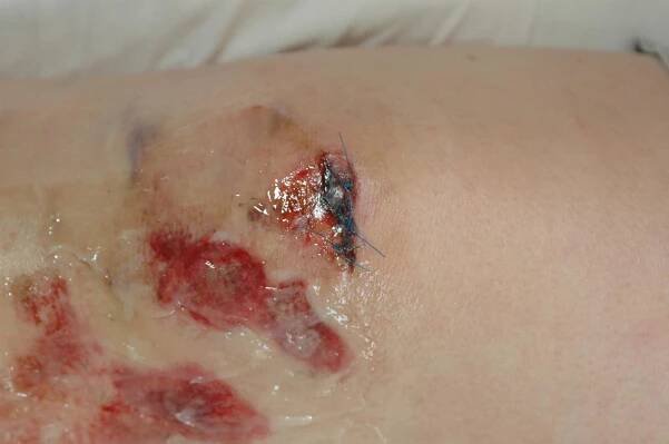 ouch 
