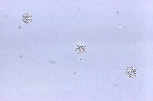 Ureaplasma urealyticum - Wikipedia