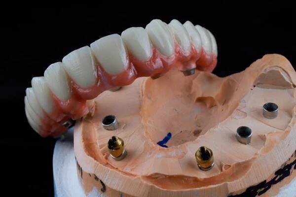 Anima-Dent