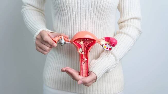 Nejen „mužský“ vzhled: Pacientky s PCOS trápí i deprese - Seznam Zprávy