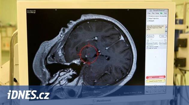 Centra pro léčbu Parkinsona chybí, speciální léčbu dostanou dva lidé ze sta - iDNES.cz
