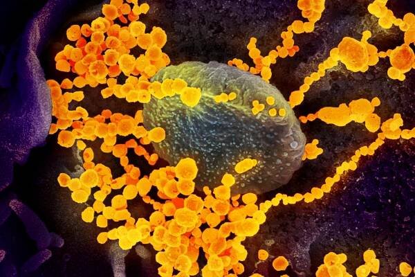 Koronavirus SARS-CoV-2 na snímku z rastrovacího elektronového mikroskopu