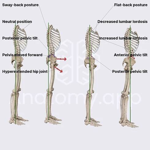 Pelvic tilt