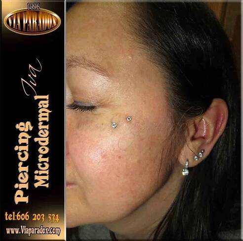 Microdermal - Via Paradox