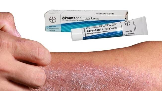 Advantan krem