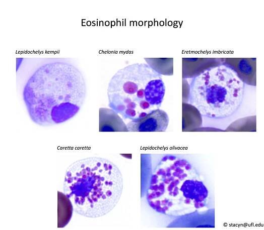 Fig.7Eosinophils