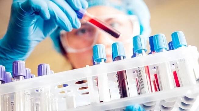 Hodnoty CRP do 5 mg/l krve jsou v pořádku. Jeho zvýšená hladina může mimo jiné značit akutní zánět - Zdraví.euro.cz