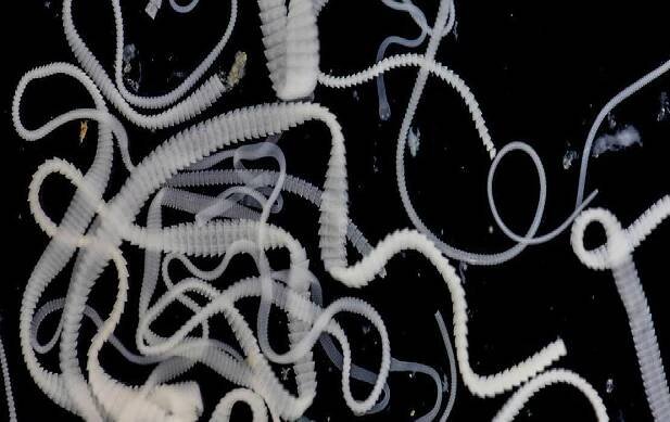 Características de los nematodos según su anatomía
