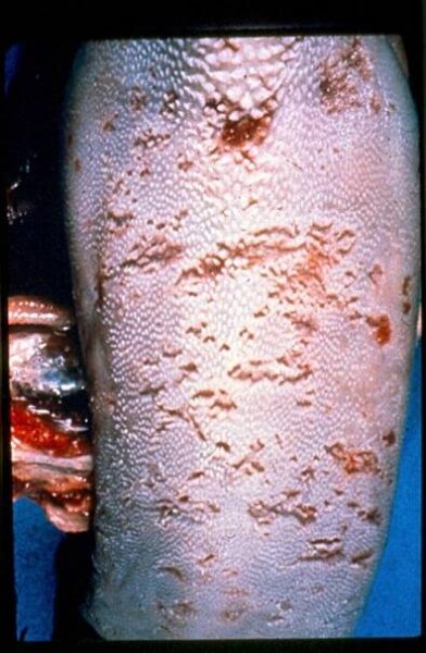 Soubor:Bovine Virus Diarrhea tongue ulcers.jpg – Wikipedie