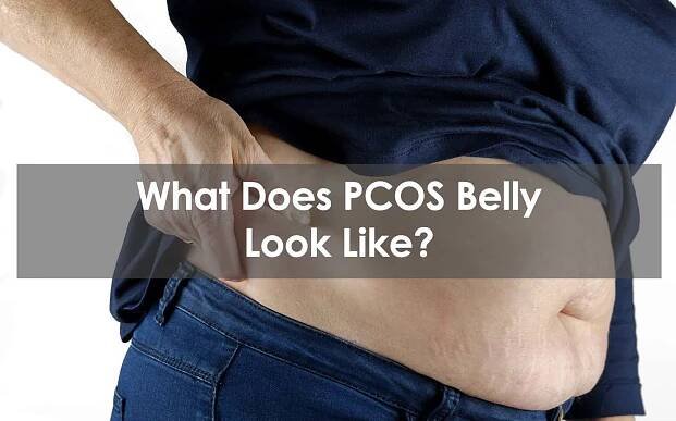 What Does PCOS Belly Look Like?