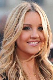 Amanda Bynes Got Blepharoplasty, The Eyelid Surgery That Is Currently On The Rise