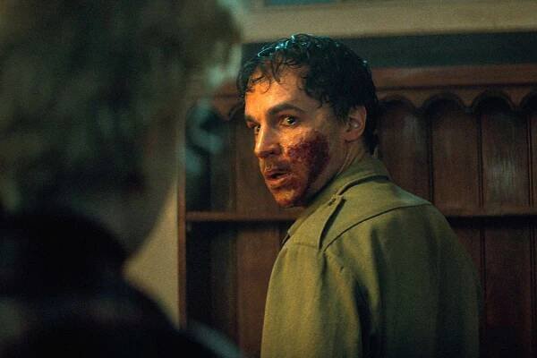 Christopher Abbott Says Chewing on His Leg in Wolf Man Was 'Gross' but 'Delicious' Thanks to Sugary Prosthetics