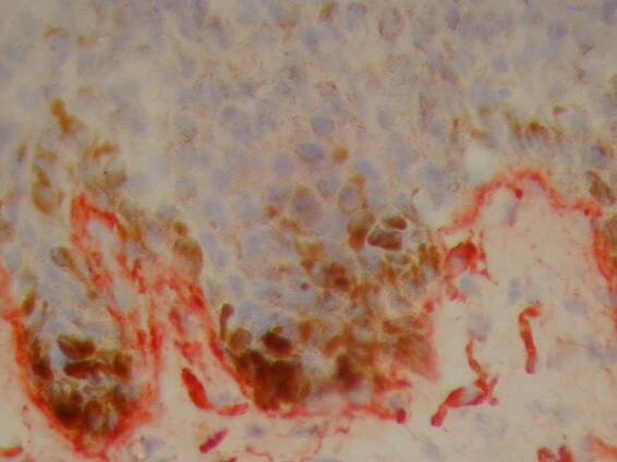 Evaluation of cosmetic and dermatologic products carried out on human skin kept in a life-like state. 