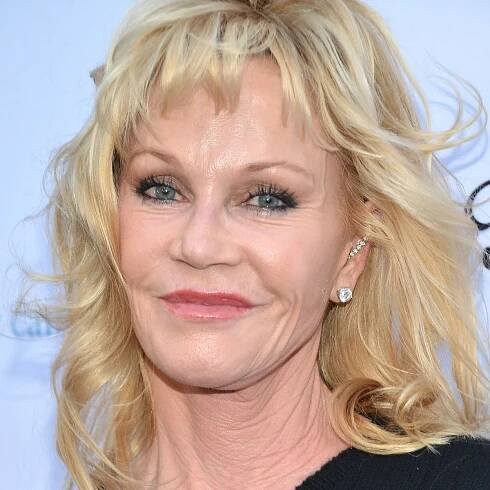 Melanie Griffith’s Plastic Surgery Disaster: Find out What Went Wrong