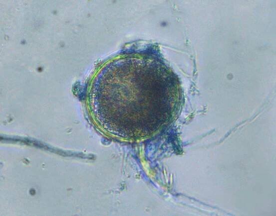 Could Trichoderma Cause Total Yeast and Mold Failure? - Medicinal Genomics