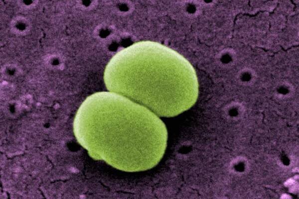 Staphylococcus epidermidis