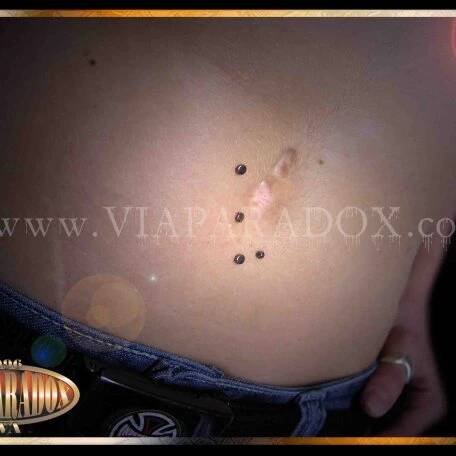Microdermal - Via Paradox