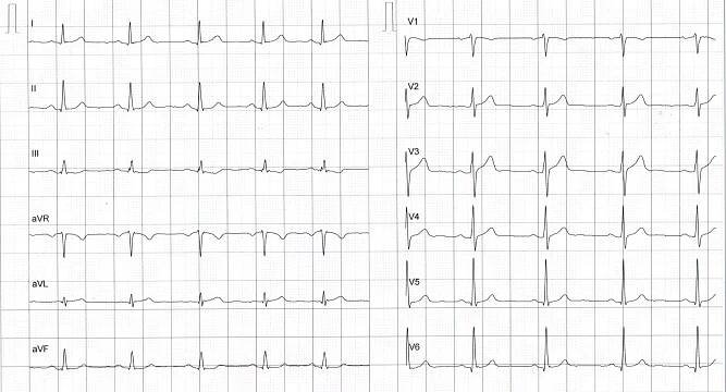 Mustafa Durak | EKG-Techniken