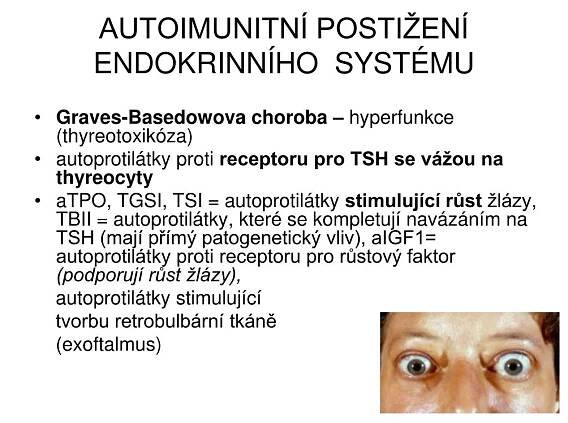 PPT - Imunodeficience a autoimunitní onemocnění PowerPoint Presentation - ID:3960798