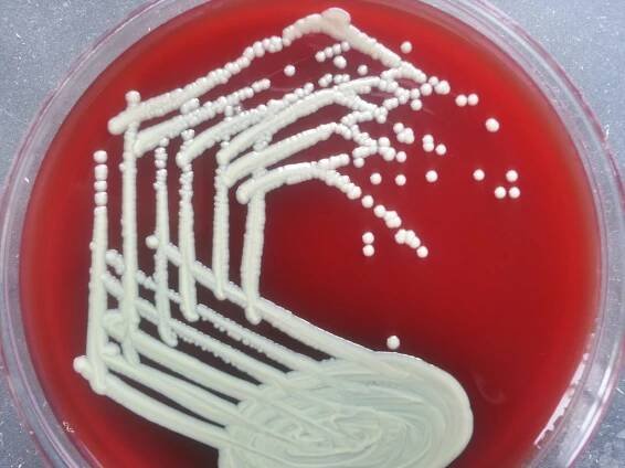 Corynebacterium-diphthriae-colonies-on-Blood-agar