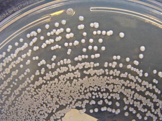 By Nathan Reading from Halesowen, UK (Staphylococcus aureus on ChromID CPS Agar - Detail) [CC BY 2.0 (http://creativecommons.org/licenses/by/2.0)], via Wikimedia Commons