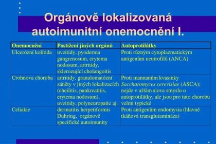PPT - Imunopatologické reakce PowerPoint Presentation, free download - ID:6183663