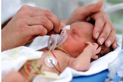 Care for Neonatal Medical Conditions Managing and Monitoring